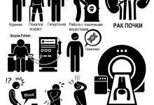 Photo of Общие признаки и первые симптомы рака почек